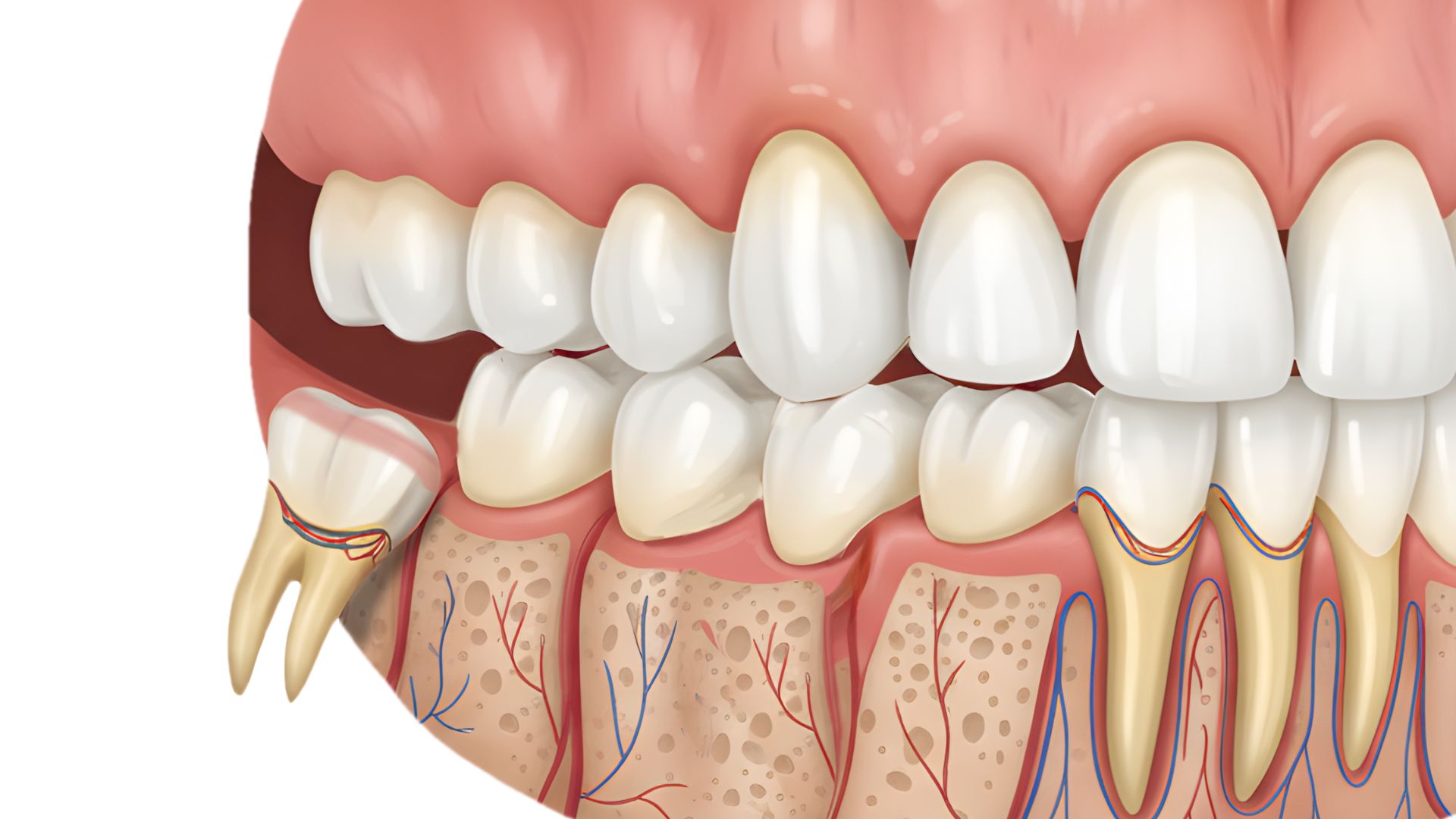 【結局いつ抜くべき？】親知らずの抜歯に最適なタイミングとは｜博多駅5分の歯医者が解説