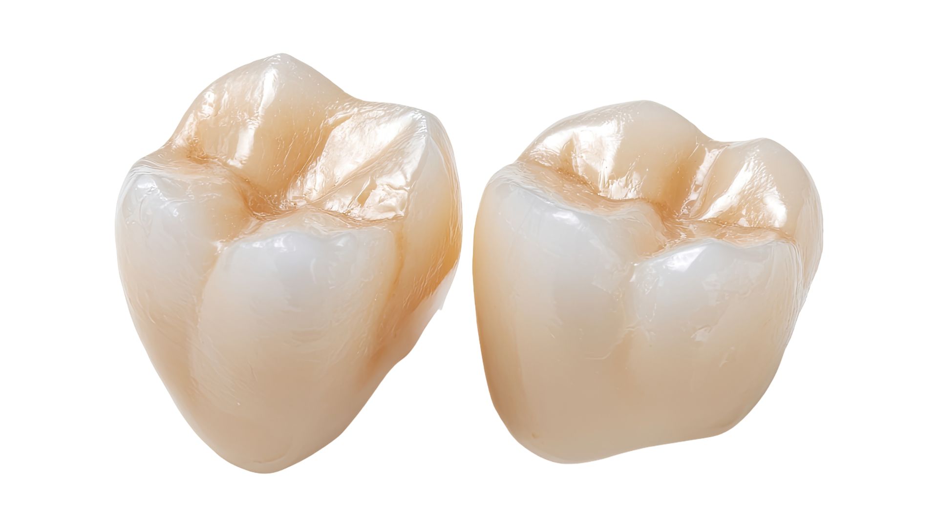 【見た目も強度も選べる！】保険外（自費）の被せ物の種類まとめ｜博多駅5分の歯医者が解説