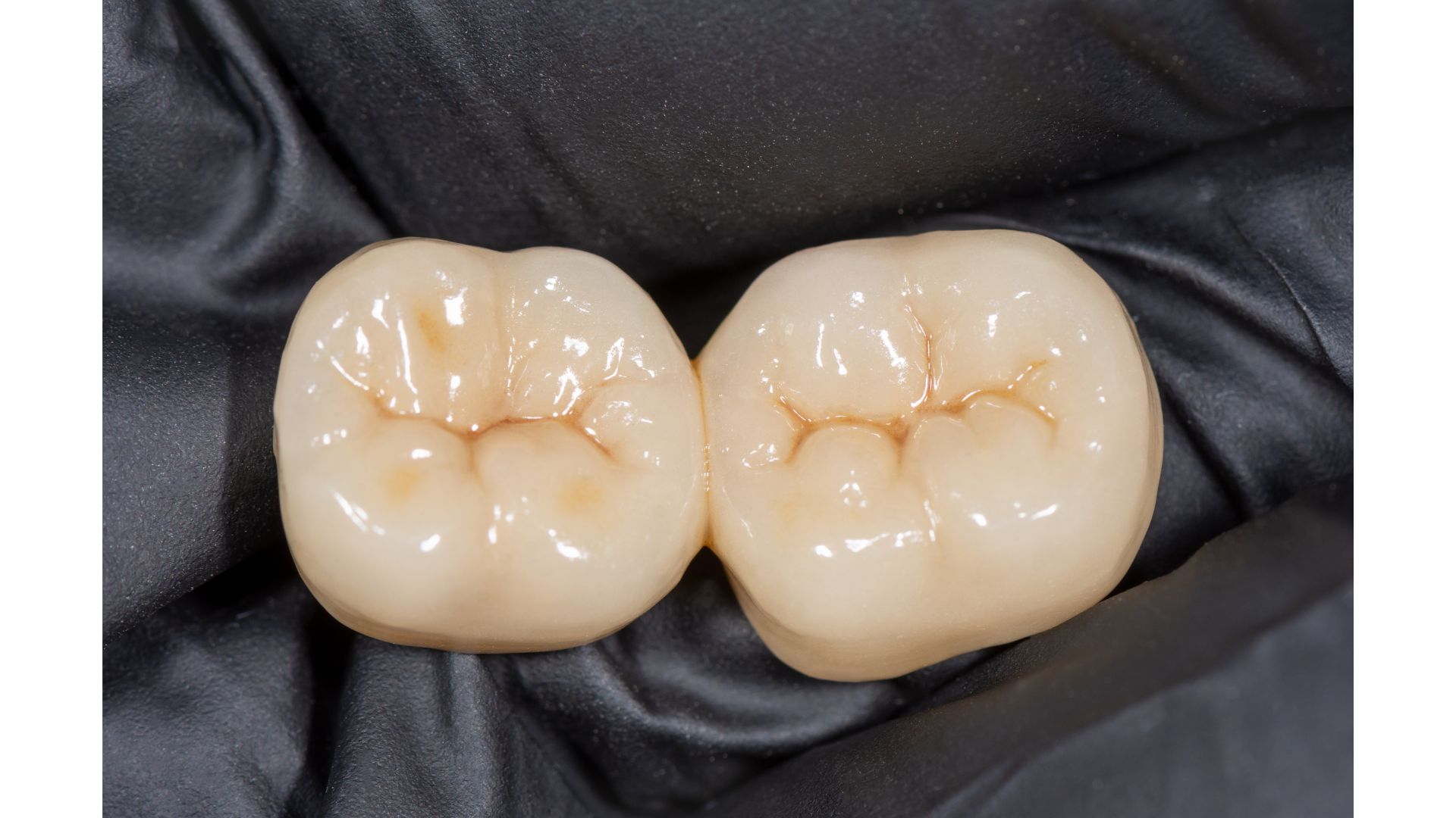 【なぜ断られる？】保険の白い詰め物をしてくれない歯医者がある本当の理由｜博多駅5分の歯医者が解説