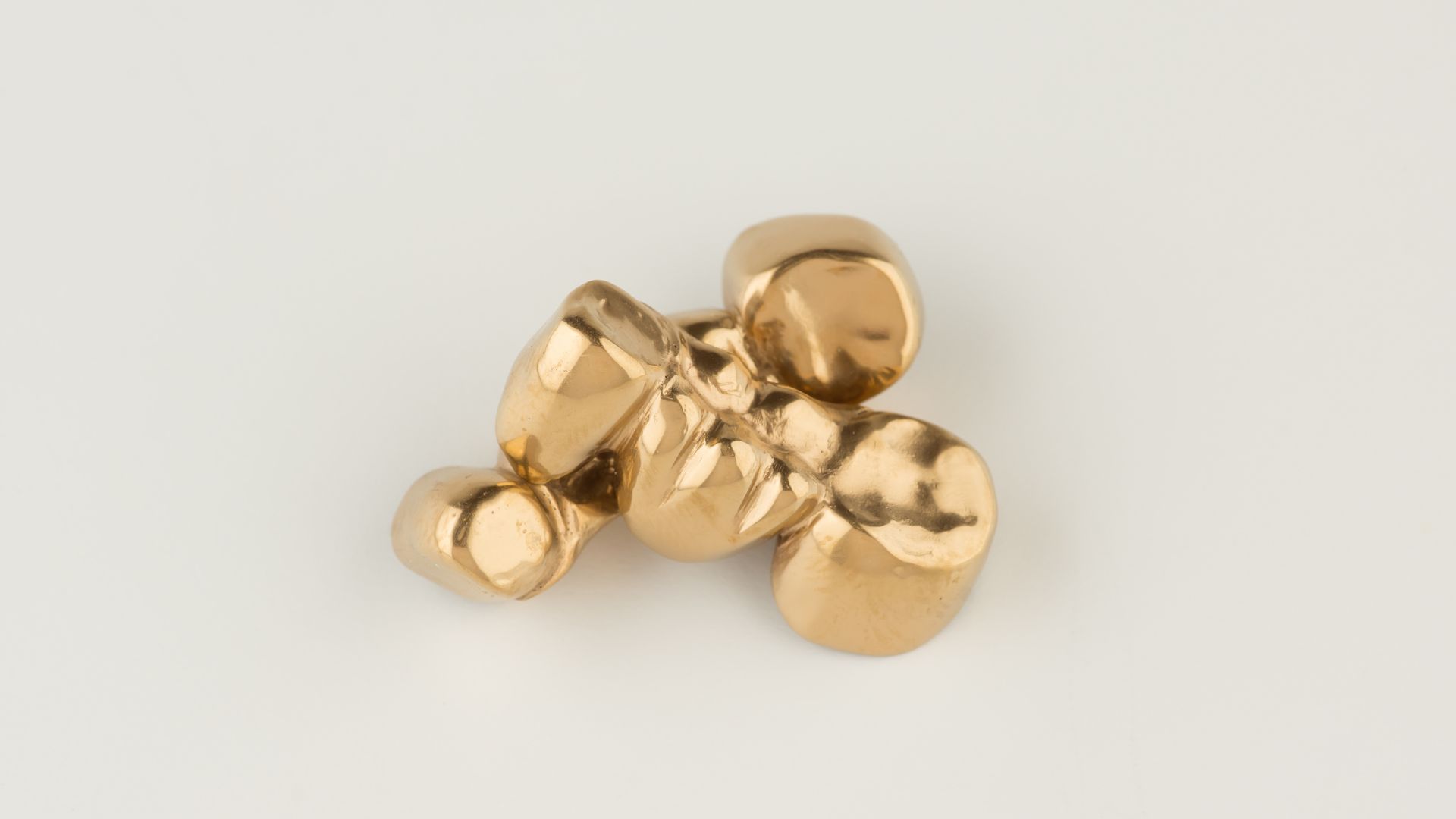 【知らないと後悔する？】金歯と銀歯の違いを歯科医師が徹底解説｜博多駅5分