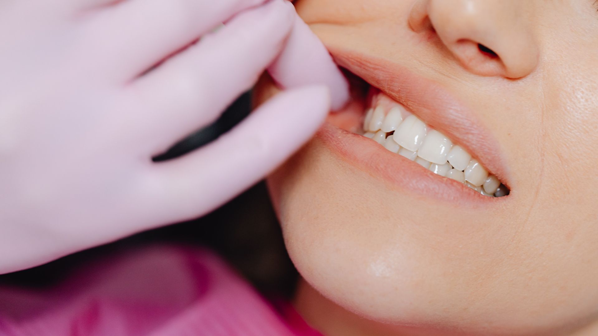 【前歯治療の仕上がりを左右する！】仮歯（プロビジョナル）の重要性｜博多駅5分の歯医者が解説