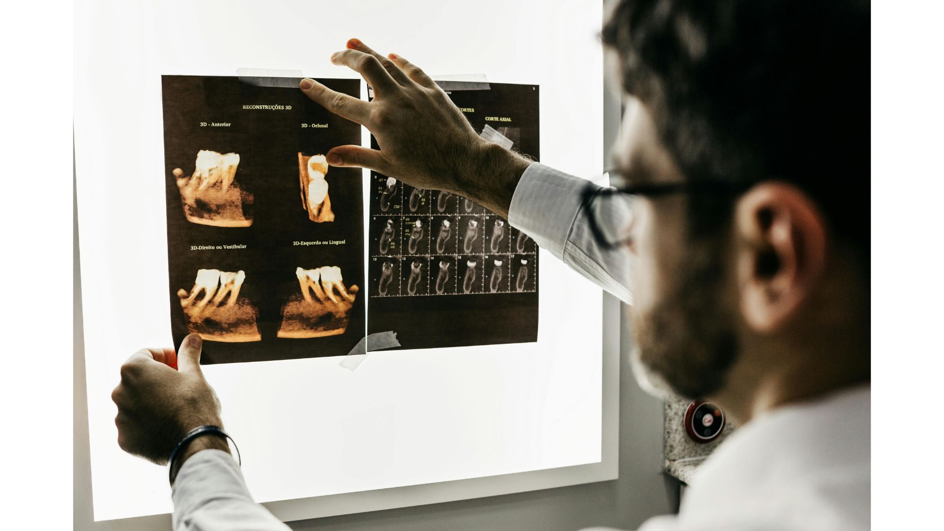 レントゲンの被曝量は大丈夫？歯科で使う検査の安全性について