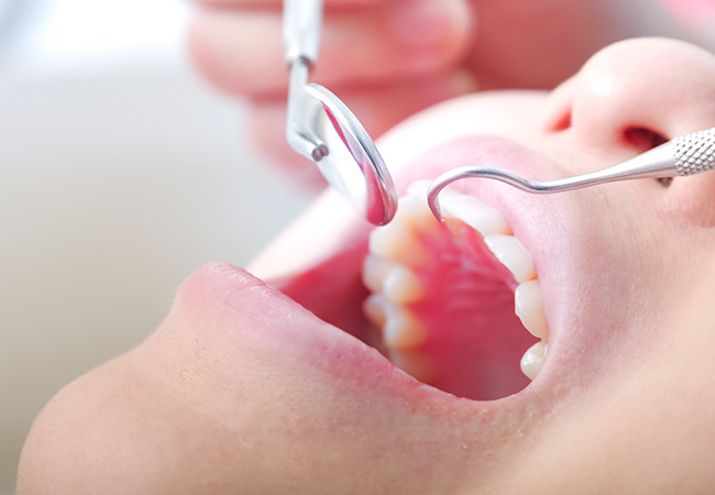 通院期間を短くしたい