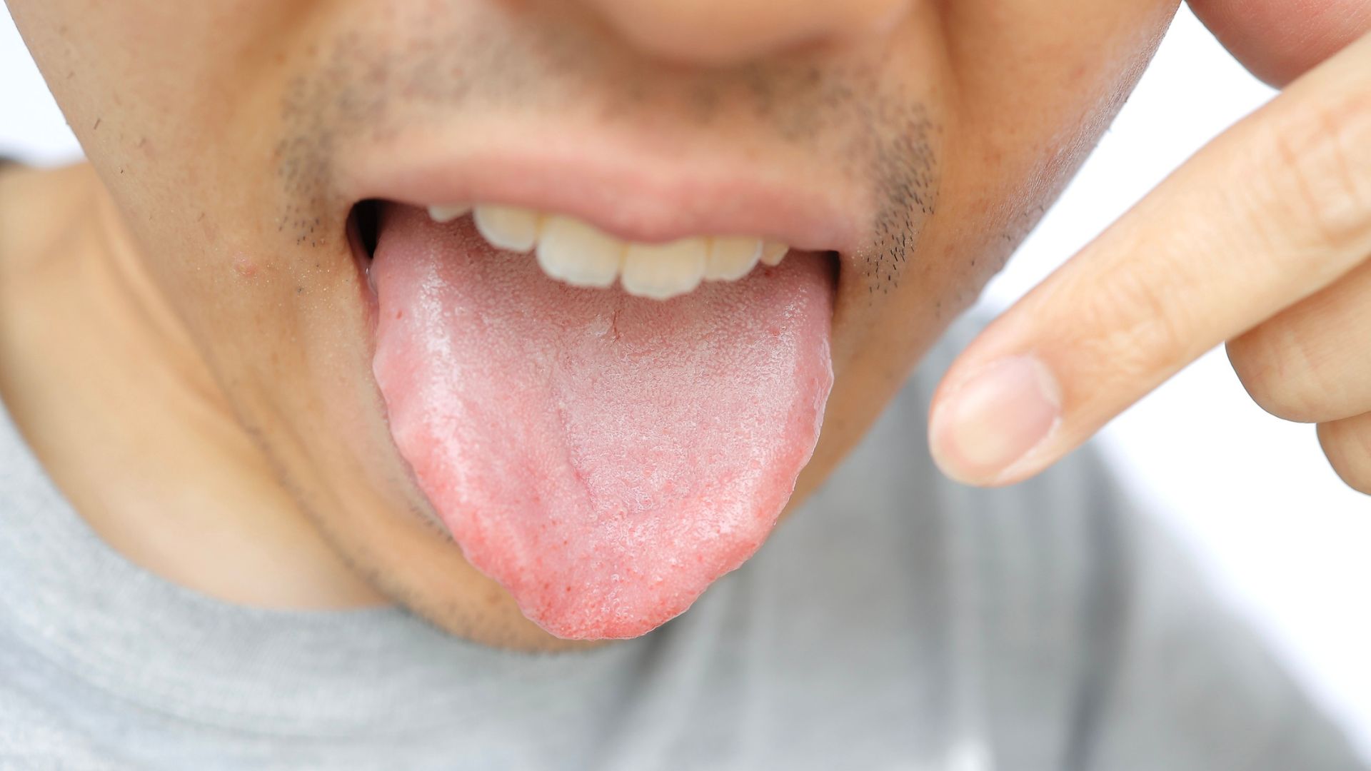 舌苔と口臭の関係とは？原因・正しい取り方・歯科受診の目安まで解説