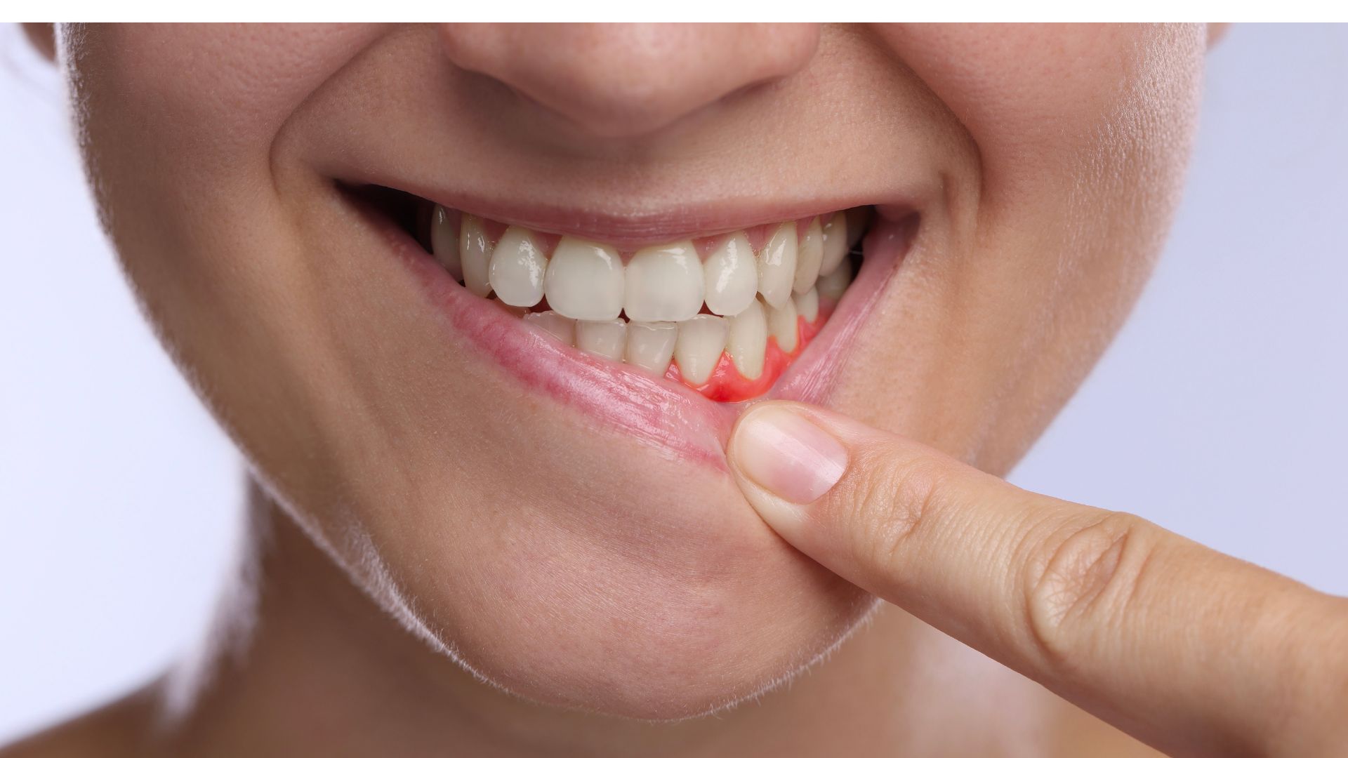 【口内炎の原因とは？】繰り返す理由と今すぐできる対策を歯科医が解説