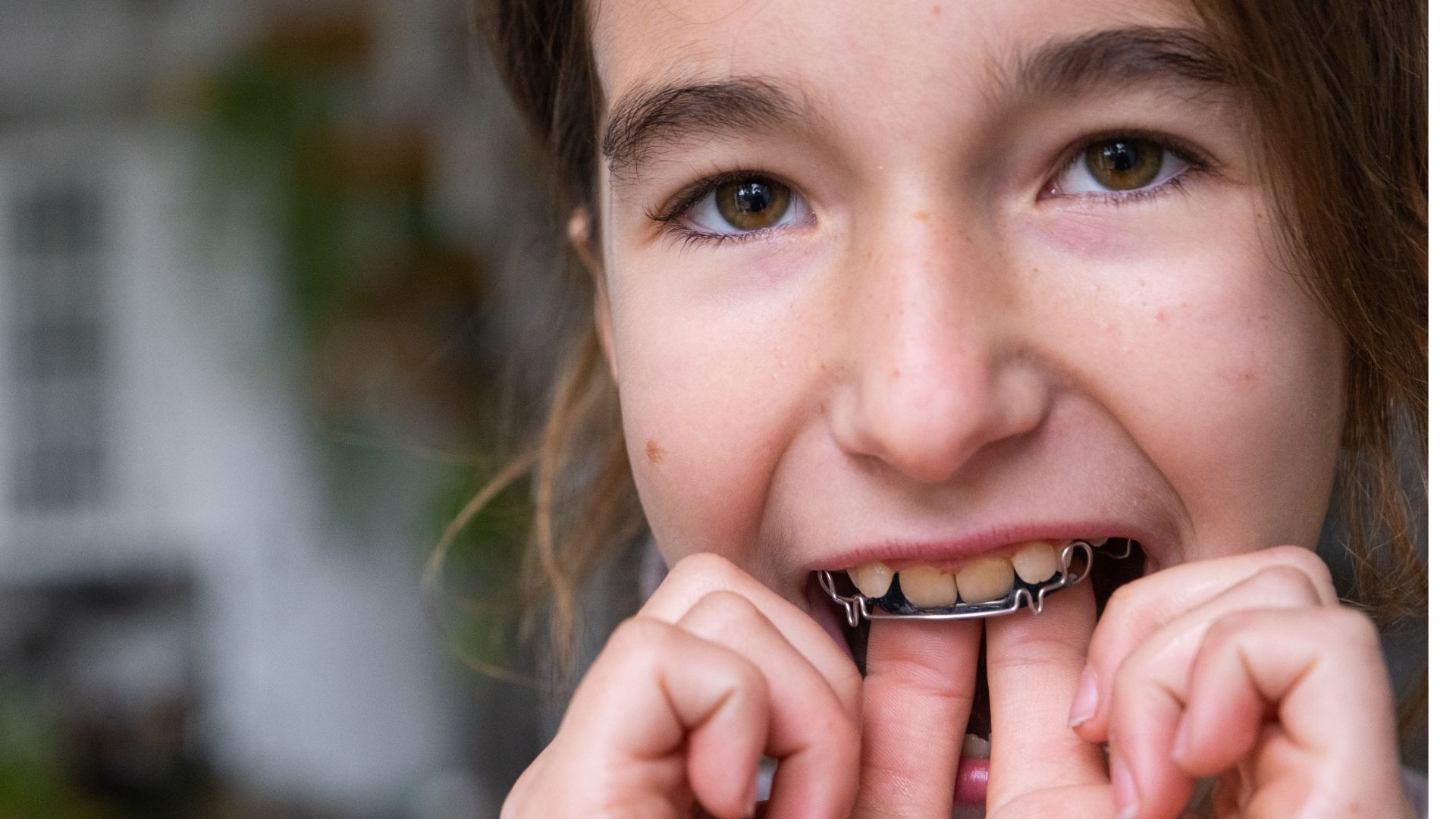 歯列矯正は何歳から？大人でも遅くない理由とベストなタイミング