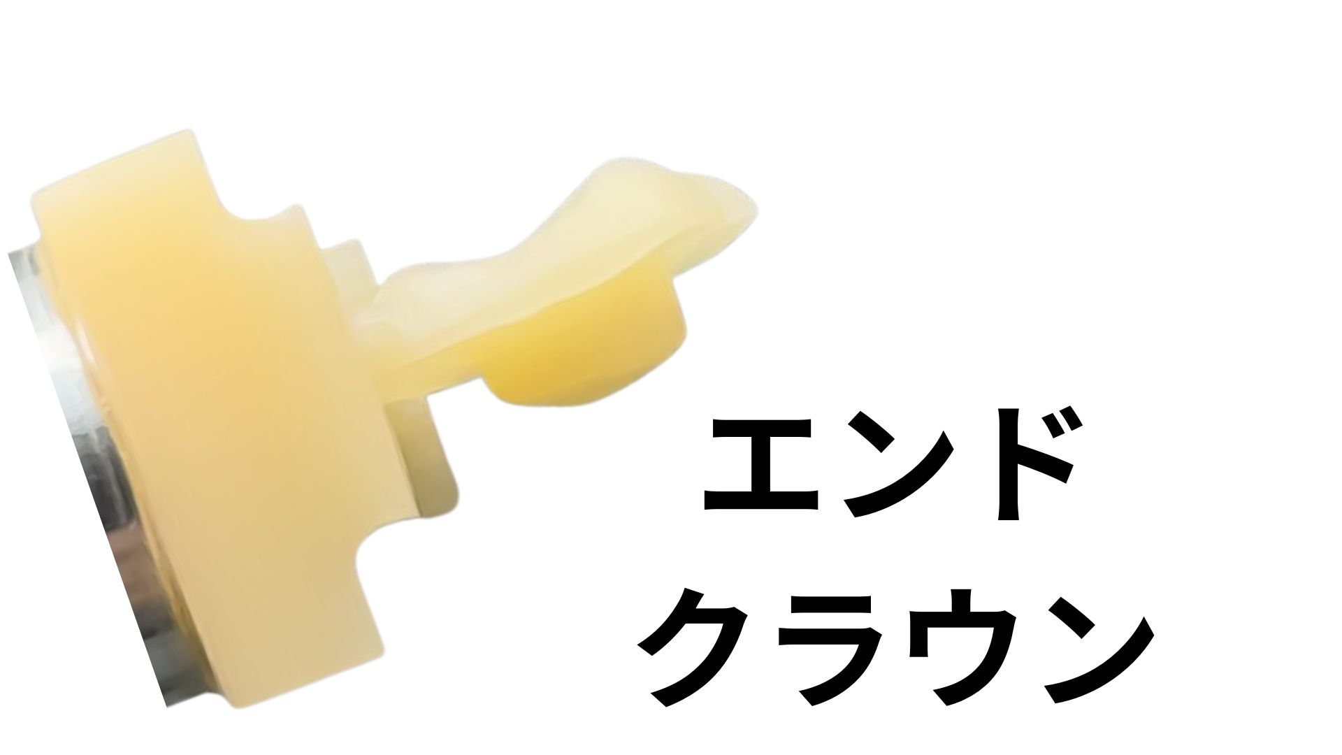 神経を取った歯の新しい選択肢！エンドクラウンとは