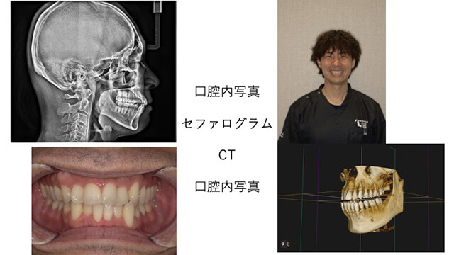 口腔内写真、セファログラム、CT、口腔内写真