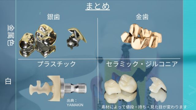 詰め物・被せ物の種類