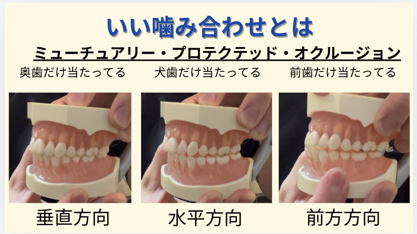 いい嚙み合わせとは